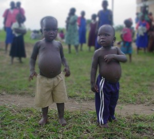 two kids swollen belly